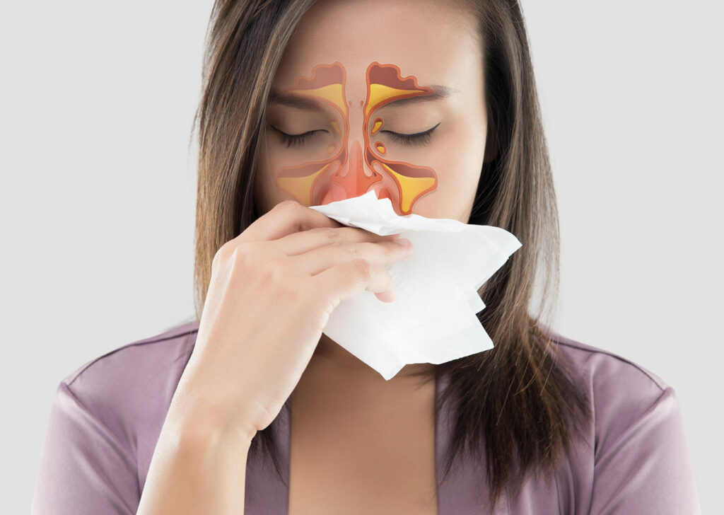 Chronic Sinusitis